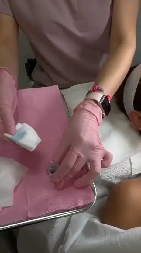 Chemical Peels at New Beauty Aesthetics